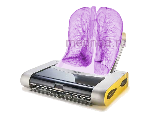 print lungs